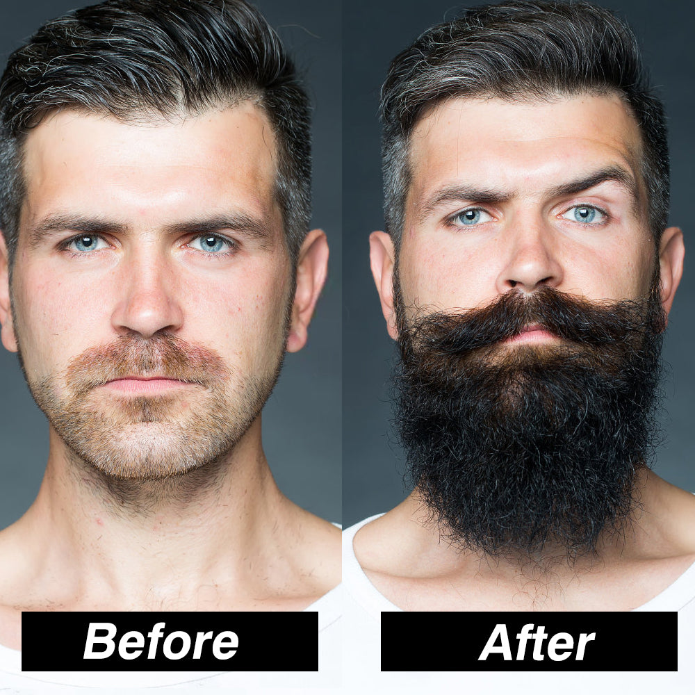 4pcs / Set The Men Beard Growth Kit